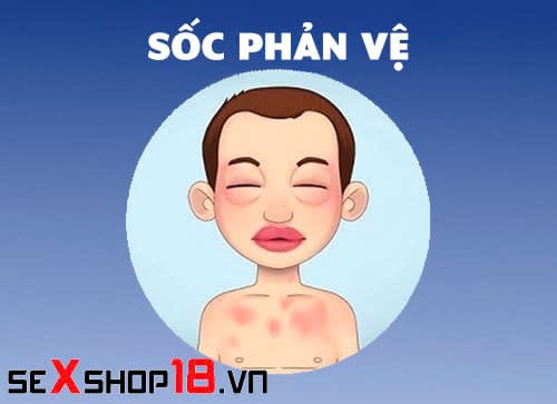 Dấu hiệu dị ứng gel bôi trơn và cách phòng tránh thế nào? 3 Dấu hiệu dị ứng gel bôi trơn nặng