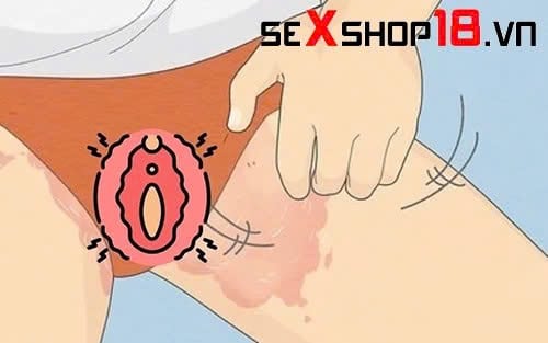 Dấu hiệu dị ứng gel bôi trơn và cách phòng tránh thế nào? 2 Dấu hiệu dị ứng gel bôi trơn ở vùng kín