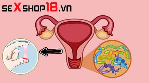 Viêm Bộ Phận Sinh Dục Nữ Là Gì? Nguyên Nhân, Triệu Chứng Và Cách Điều Trị 1 bệnh lý viêm bộ phận sinh dục nữ là gì