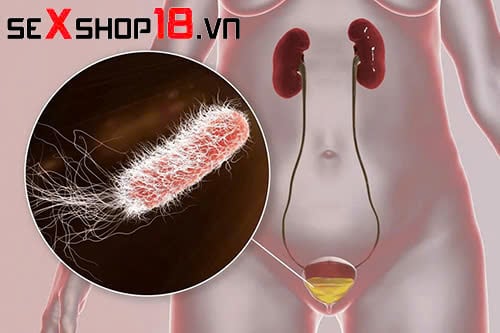 Bị viêm đường tiết niệu có quan hệ được không? Bác sĩ giải đáp chi tiết 1 nam nữ bị viêm đường tiết niệu có quan hệ được không