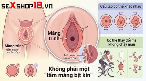 Giải đáp: Lần đầu quan hệ không ra máu có sao không? 3 Lần đầu quan hệ không ra máu do cấu tạo màng trinh
