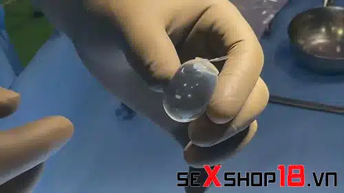 Đặt tinh hoàn nhân tạo là gì? Có ảnh hưởng sức khỏe không? 2 Phẫu thuật đặt tinh hoàn nhân tạo là gì cho nam