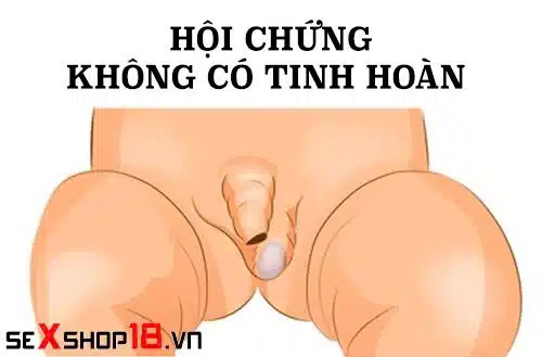 Đàn ông chỉ có 1 tinh hoàn có sinh con được không? 2 Đàn ông còn 1 tinh hoàn có sinh con được không?
