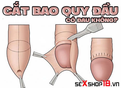 cat bao quy dau co dau khong