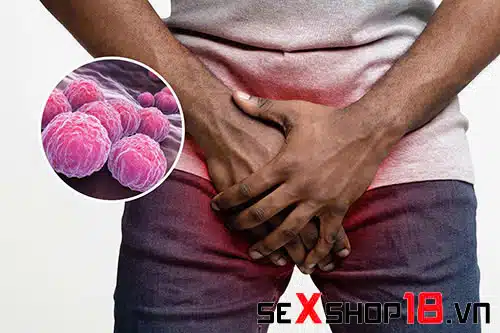 Viêm bao quy đầu có quan hệ được không? Giải đáp y khoa 3 Viêm bao quy đầu có quan hệ được không? nguyên nhân gây viêm