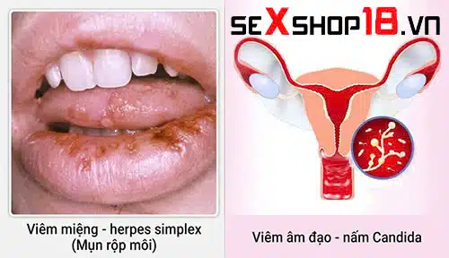 Hôn vùng kín có thai không? Sự thật khoa học cần biết 3 Hôn vùng kín có thai không và rủi ro sức khỏe