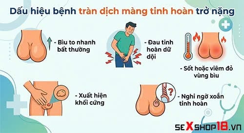 Tràn dịch màng tinh hoàn bao lâu thì khỏi? Bác sĩ giải đáp 4 Con trai bị tràn dịch màng tinh hoàn bao lâu thì khỏi?