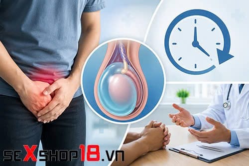 Tràn dịch màng tinh hoàn bao lâu thì khỏi? Bác sĩ giải đáp 2 Người bị tràn dịch màng tinh hoàn bao lâu thì khỏi?
