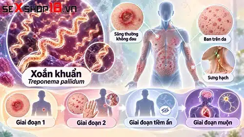 Bị giang mai có quan hệ được không? Thời điểm nào an toàn? 1 bị giang mai có quan hệ được không theo từng giai đoạn bệnh