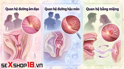 Bị giang mai có quan hệ được không? Thời điểm nào an toàn? 3 bị giang mai có quan hệ được không và các hình thức lây truyền