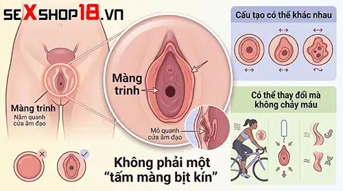 Giải đáp: Lần đầu quan hệ không ra máu có sao không? 3 Lần đầu quan hệ không ra máu do cấu tạo màng trinh